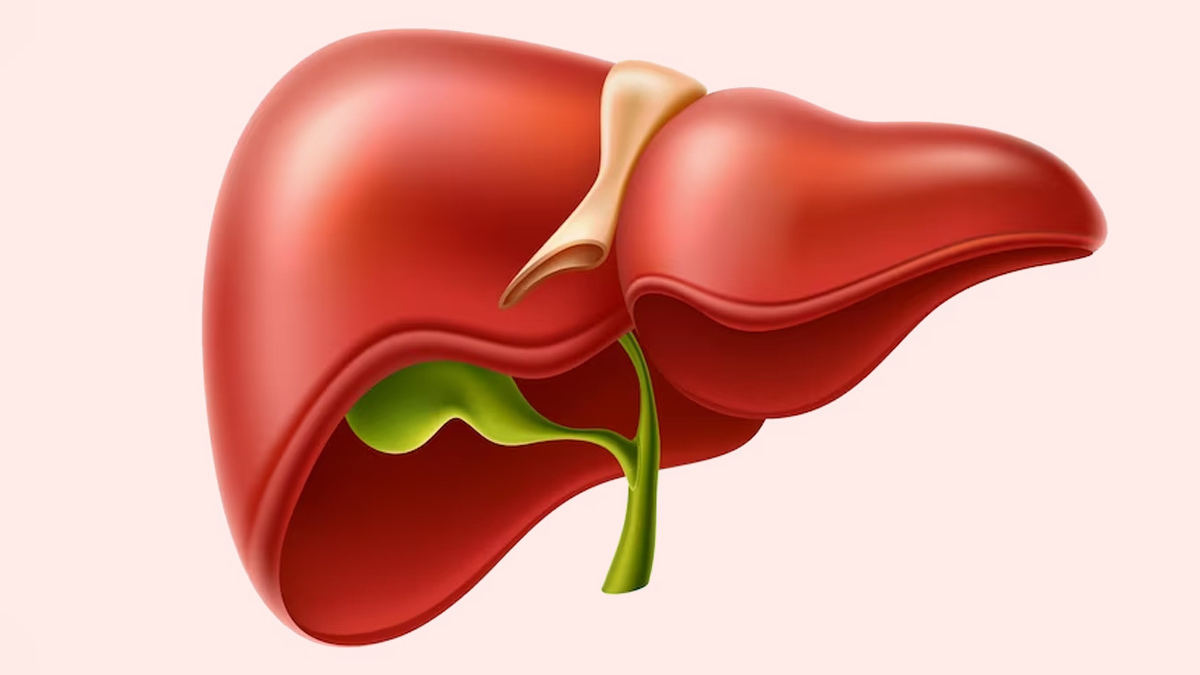 Ayurvedic treatment of fatty liver