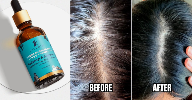 Pilgrim hair serum स्कैल्प की गहराई से देखभाल करता है बालों के पुनर्निर्माण और घनत्व में सुधार लाता है!