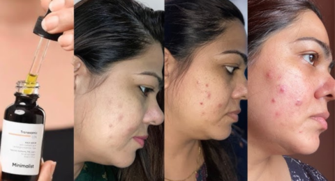 Minimalist Niacinamide Serum Minimalist नियासिनमाइड सीरम – आपकी त्वचा के लिए शक्तिशाली
