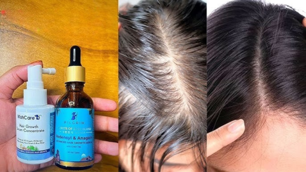 Pilgrim hair growth serum क्या आप बालों के झड़ने से परेशान हैं? Pilgrim Hair Growth Serum के साथ सिर्फ 4 हफ्तों में बालों का झड़ना कम करें