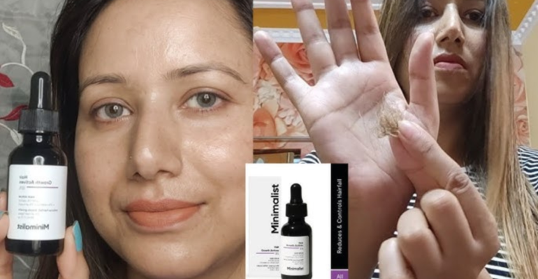Bodywise hair growth serum बालों की पतली देखभाल और थिनिंग रोकने का असरदार इलाज