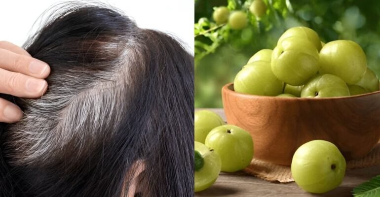 आंवले से सफेद बाल काले